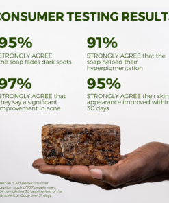 Anti-Acne & Dark Spots African Soap Bar