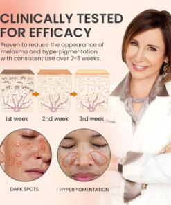 Melasma Lightening Serum