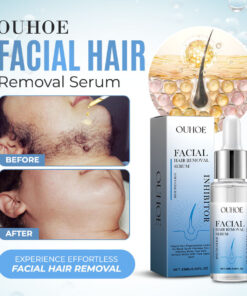 PCOS Facial Hair Natural Treatment At Home