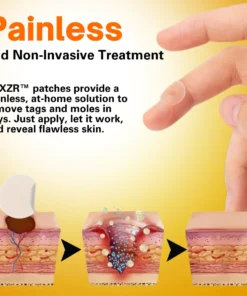 AEXZR™ Bee Venom Tags & Moles Remover Patches