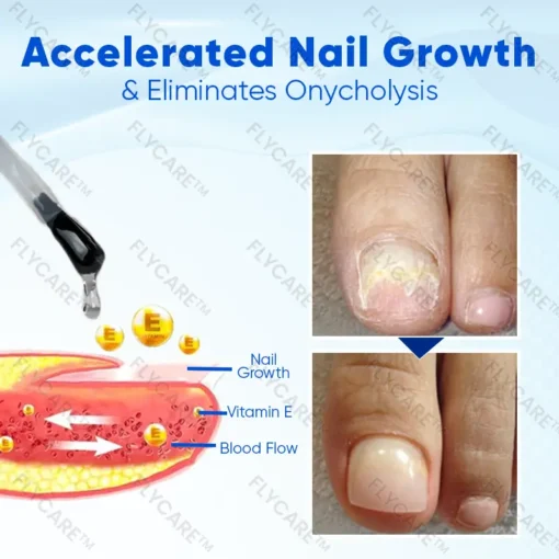 FLYCARE™ OnyxoGuard Nail Growth and Repair Serum