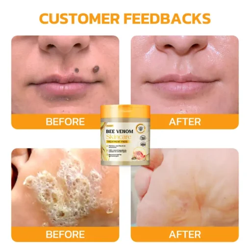 Furzero™ Bee Venom Skincare Treatment Pads