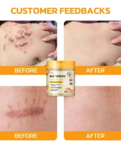 Furzero™ Bee Venom Skincare Treatment Pads