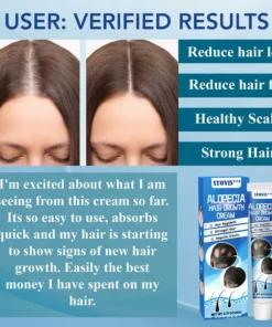 STOVIS™ Alopecia Recovery Hair Regrowth Cream