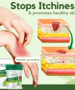 AEXZR™ Herbal Tinea Corporis Cream