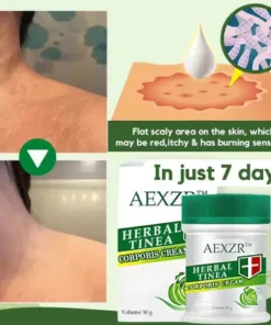 AEXZR™ Herbal Tinea Corporis Cream