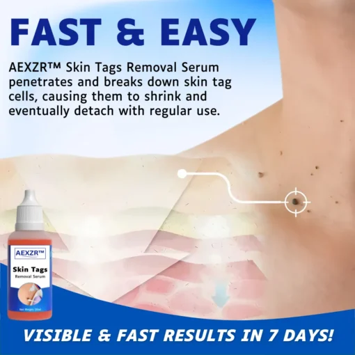 AEXZR™ Skin Tags Removal Serum