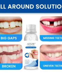 AEXZR™ Thermal Gaps Moldable Teeth