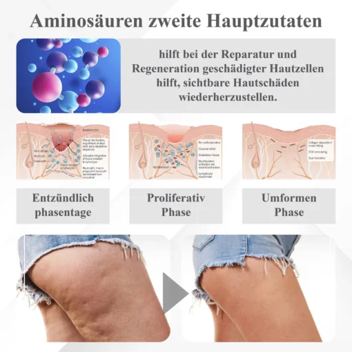 ATTDX™ Insulin Gewichtskontroll Körpercreme