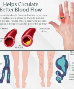 CircuWave™ Ultrasonic VascularSupport Ring
