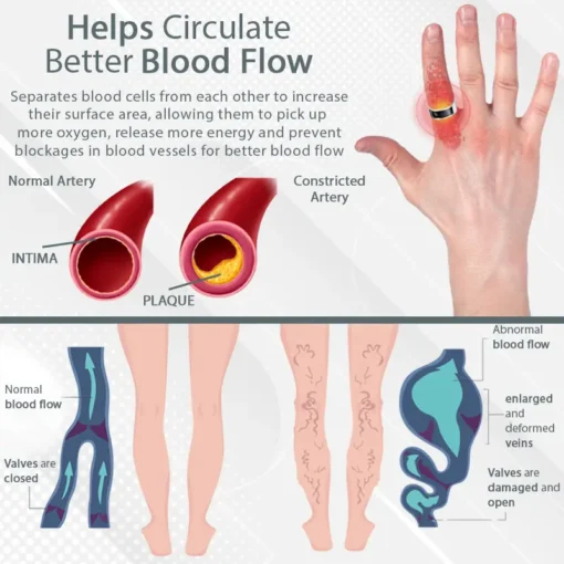 CircuWave™ Ultrasonic VascularSupport Ring