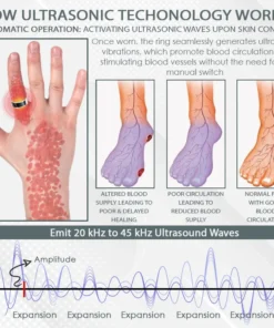 CircuWave™ Ultrasonic VascularSupport Ring