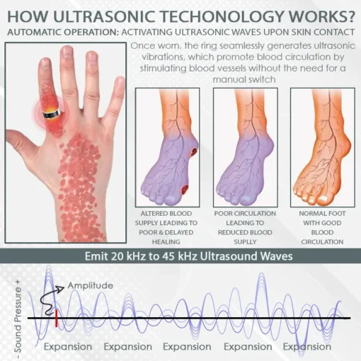 CircuWave™ Ultrasonic VascularSupport Ring