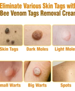 Lotmay™Australian Bee Venom Tags Removal Cream