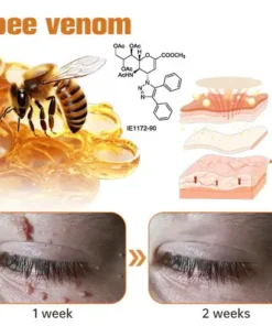 Oveallgo™ WartGone Bee Venom Treatment Patch