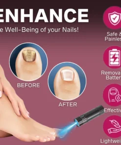 AEXZR™ Handheld Laser Nail Treatment Device