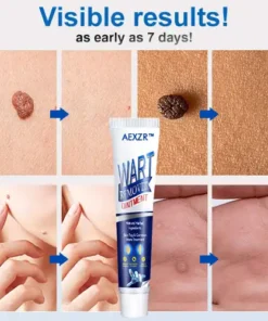 AEXZR™ Wart Removal Ointment