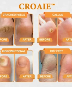 CROAIE™ Bee Venom & Herbal Slimming Foot Patches