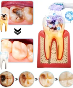 DOCTIA™ TeethRestoration Mineralpulver