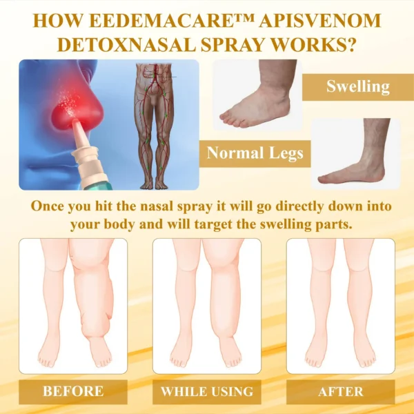 EdemaCare™ ApisVenom DetoxNasal Spray