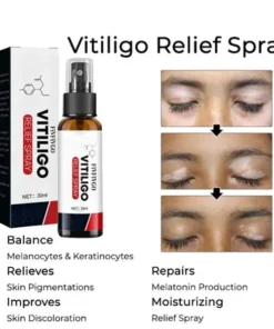 Fivfivgo™ Vitiligo Relief Spray