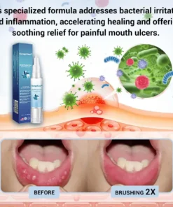 GarageLine™ Oral Protective Treatment Gel