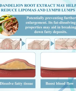 Lovilds™ LumpsClear Lymph Say Goodbye to Lipomas and Swelling