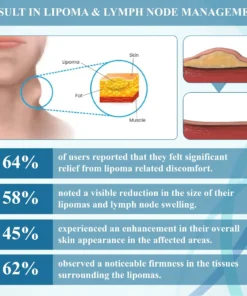 Lovilds™ LumpsClear Lymph Say Goodbye to Lipomas and Swelling