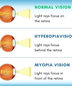 OptiRevive™ Daily Liquid Lens