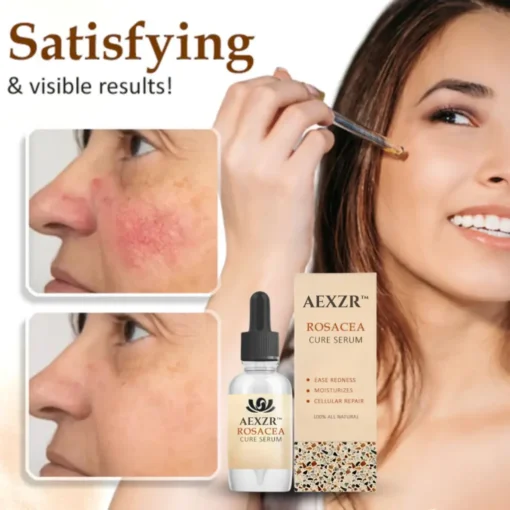 AEXZR™ Rosacea Cure Serum