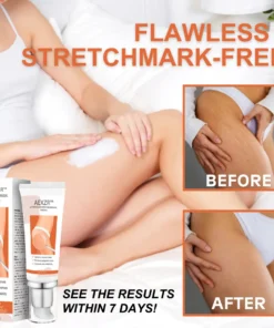 AEXZR™ Stretchmarks Removal Cream