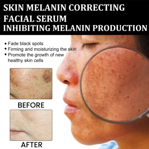 AQA™ Melanin Correcting Brightening Serum - Image 2