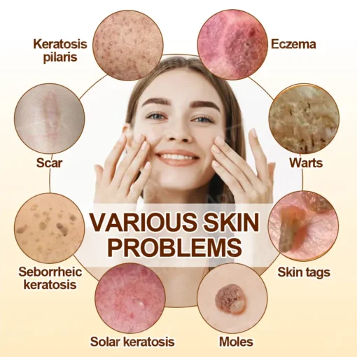 ApisDerm™ VenomClear Skin Treatment Balm - Image 2