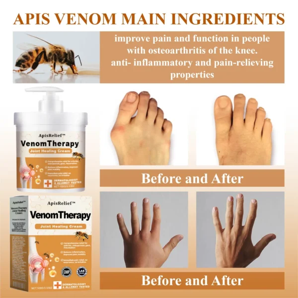 ApisHeal™ ApisVenom Turmeric Joint Healing Cream