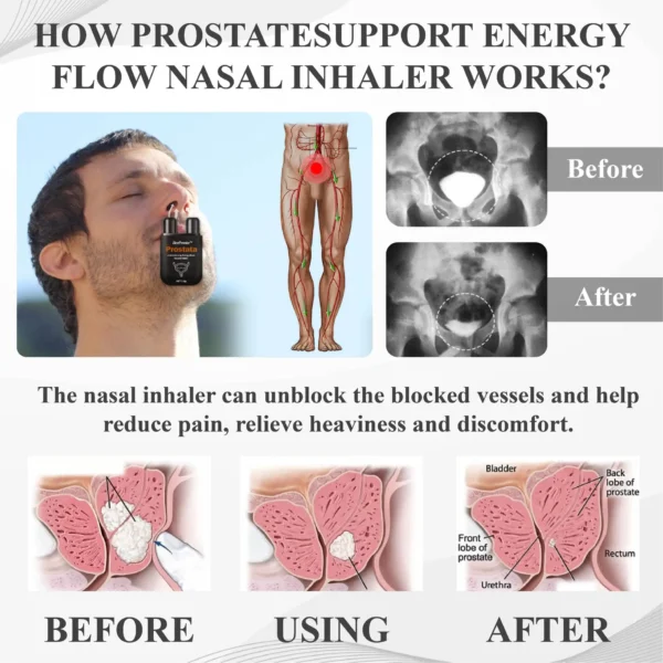 BeeProsta™ ProstateSupport Energy Flow Nasal Inhaler