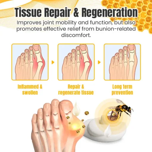 Ceoerty™ HalluxCure Bee Venom Relief Cream - Image 4