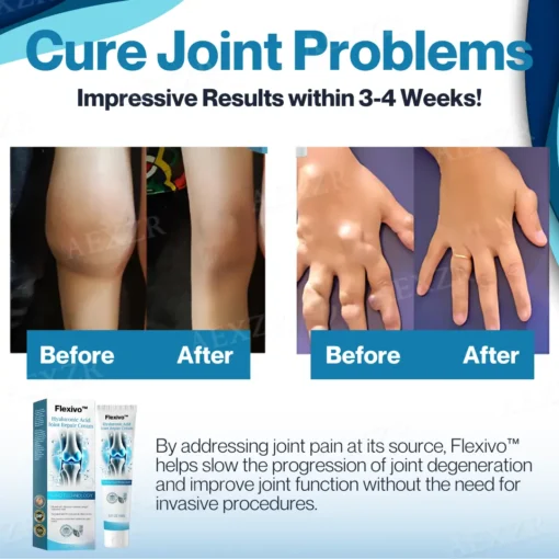 Flexivo™ Hyaluronic Acid Joint Repair Cream - Image 2