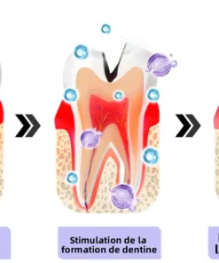 Oyikey™ Teeth Restoration Poudre Minérale