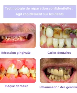 Oyikey™ Teeth Restoration Poudre Minérale