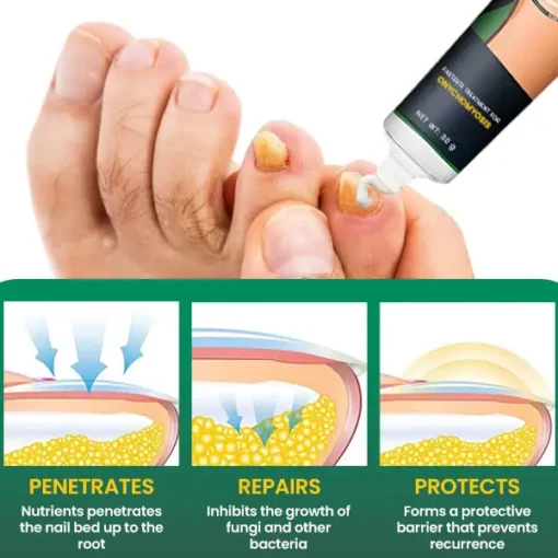 PANNIMA™ Nail Care Anti Fungal Cream - Image 4