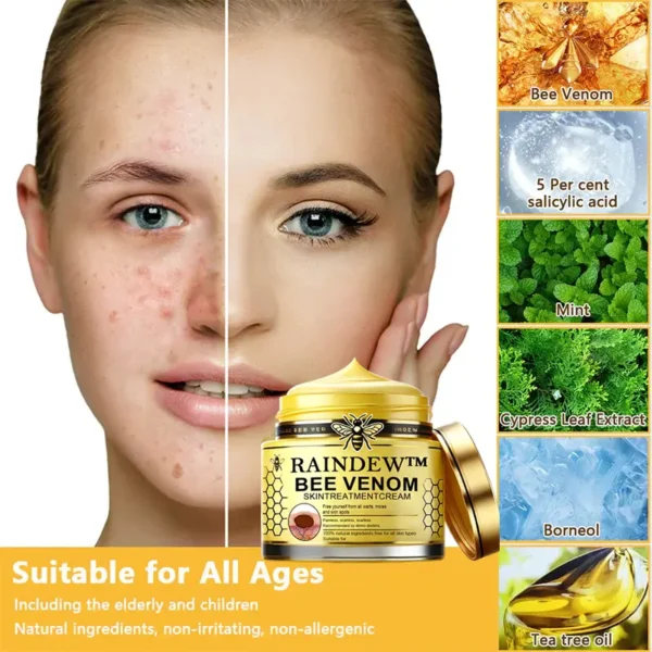 Raindew™ Bee Venom Skin Treatment Cream