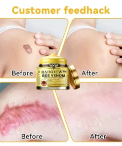 Raindew™ Bee Venom Skin Treatment Cream