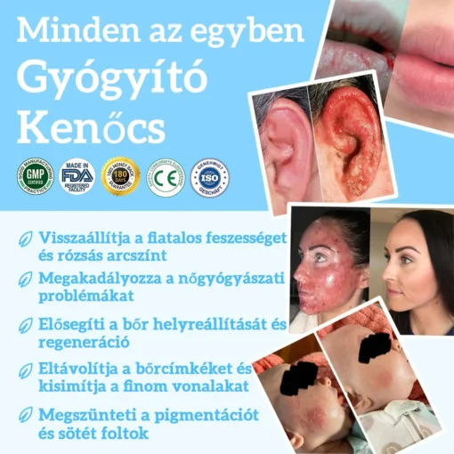 ADNOON® Kígyóolaj Teljeskörű Bőrápoló Krém - Image 5