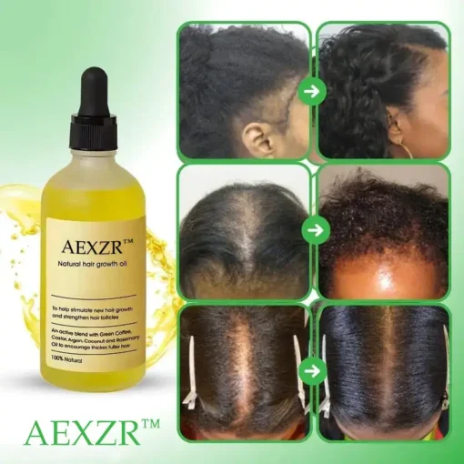 AEXZR™ Natural Hair Growth Serum - Image 4