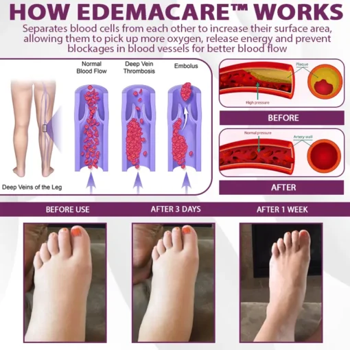 EdemaCare™ Elderberry Lymphatic Massage Cream