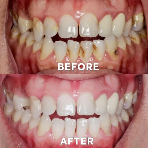 Ourlyard™ Tooth Health Mineral Powder - Image 2