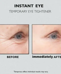 Seurico™ Instant Eye Temporary Eye Tightener