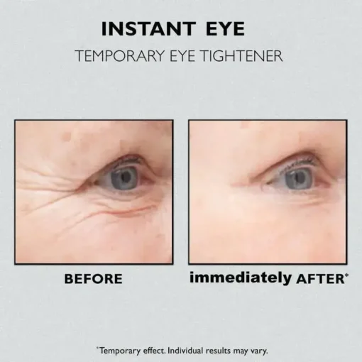 Seurico™ Instant Eye Temporary Eye Tightener