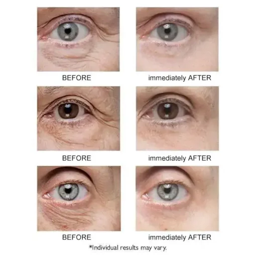 Seurico™ Instant Eye Temporary Eye Tightener